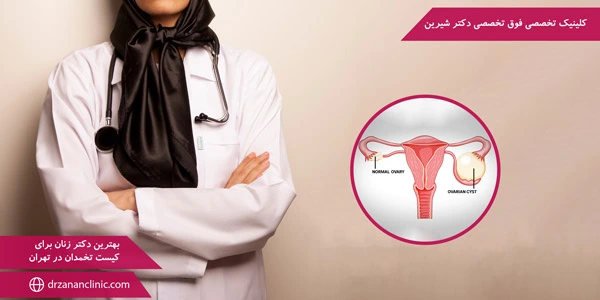 The-best-gynecologist-for-ovarian-cyst-in-Tehran